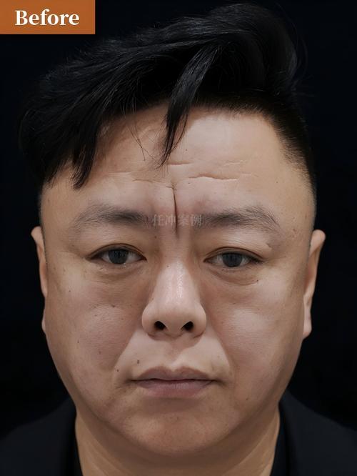 平安24小时在线套医保微信能用吗怎么弄？官方解答来了